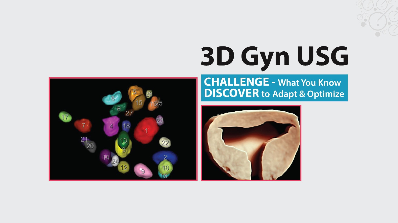 3D Gyn USG