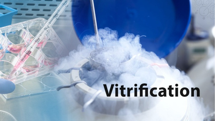 Vitrification